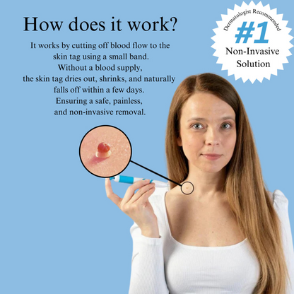 TagPro™ Kit: No More Skin Tags
