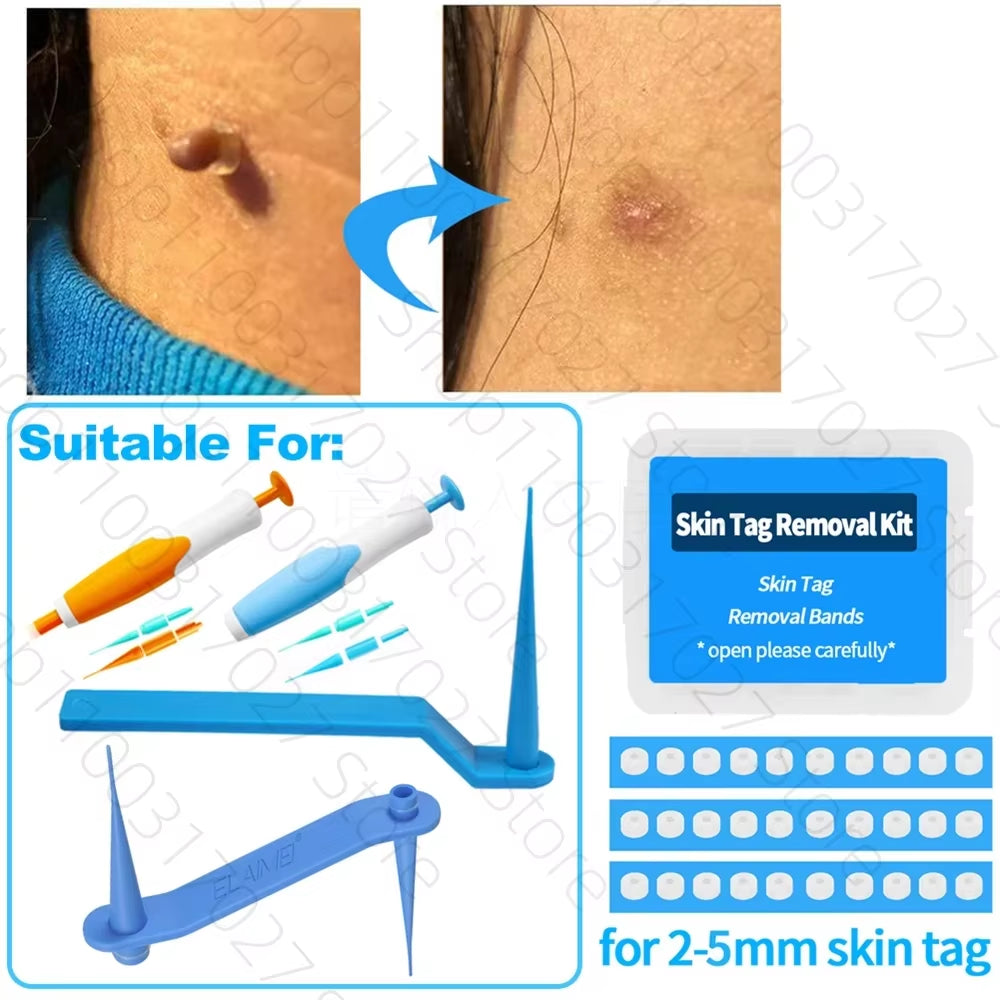 30Pcs/Box Remove Skin Tag Shrink Rubber Ring Non Toxic Health Beauty Skin Care Tools Tag Removal Mole Wart Removal Face Care