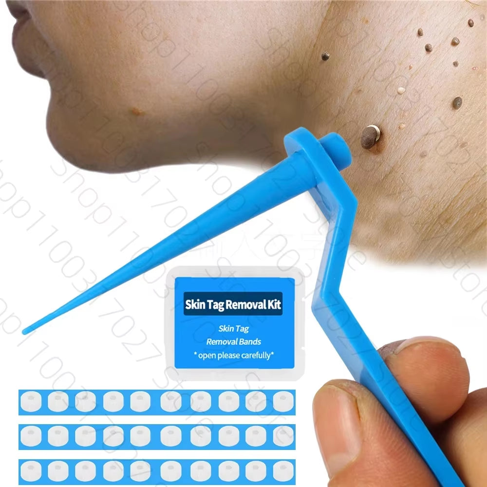 30Pcs/Box Remove Skin Tag Shrink Rubber Ring Non Toxic Health Beauty Skin Care Tools Tag Removal Mole Wart Removal Face Care